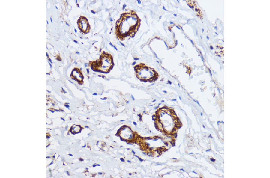Immunohistochemistry - Anti-Myosin light chain kinase/MLCK Antibody (A16051) - Antibodies.com