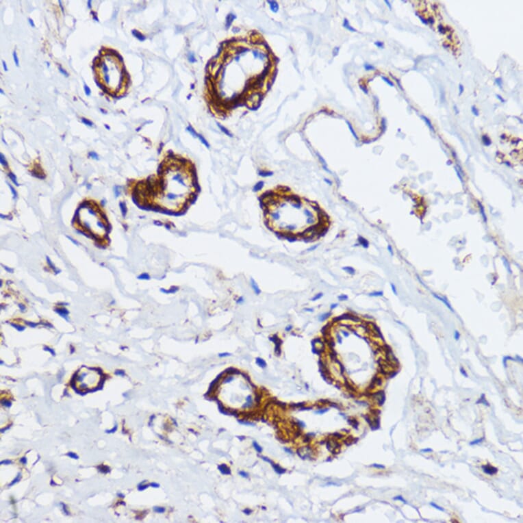 Immunohistochemistry - Anti-Myosin light chain kinase/MLCK Antibody (A16051) - Antibodies.com