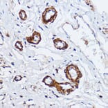 Immunohistochemistry - Anti-Myosin light chain kinase/MLCK Antibody (A16051) - Antibodies.com