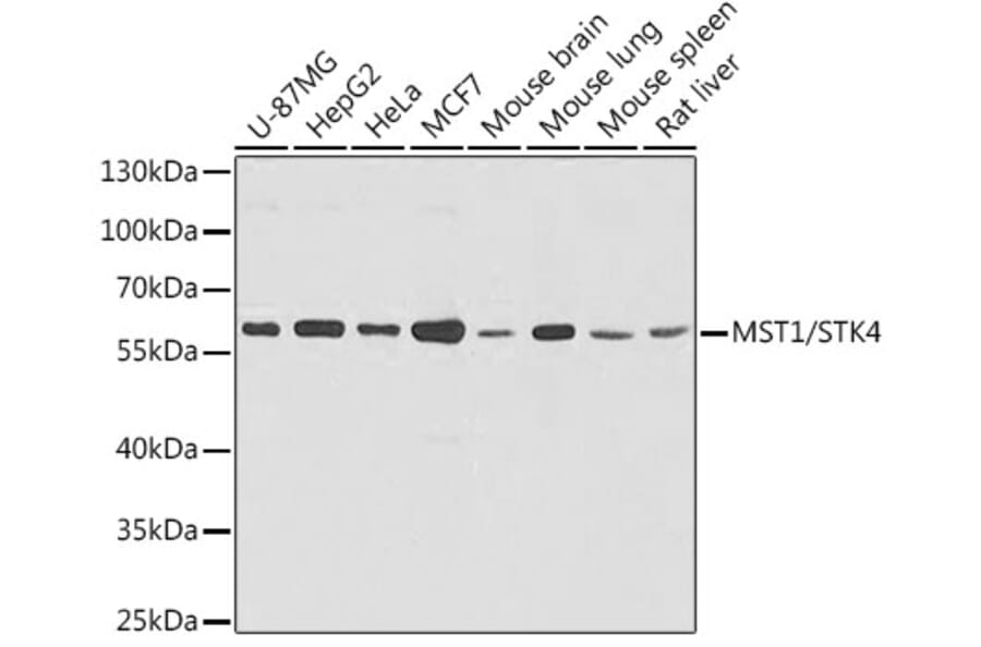 Western Blot - Anti-Serine/threonine-protein kinase 4/MST-1 Antibody (A16052) - Antibodies.com