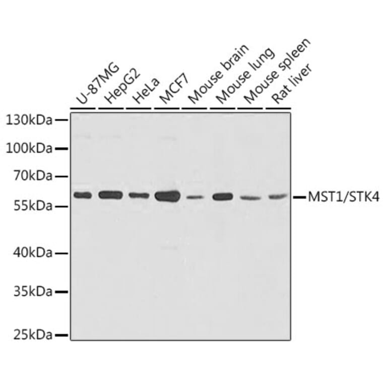 Western Blot - Anti-Serine / threonine-protein kinase 4 / MST-1 Antibody (A16052) - Antibodies.com