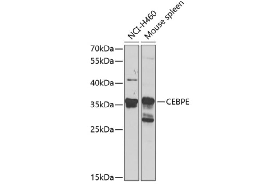Western Blot - Anti-CEBPE Antibody (A16053) - Antibodies.com