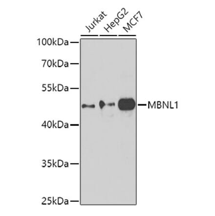 Western Blot - Anti-MBNL1 Antibody (A16054) - Antibodies.com