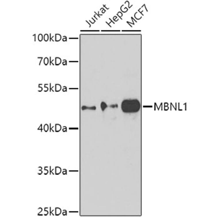 Western Blot - Anti-MBNL1 Antibody (A16054) - Antibodies.com