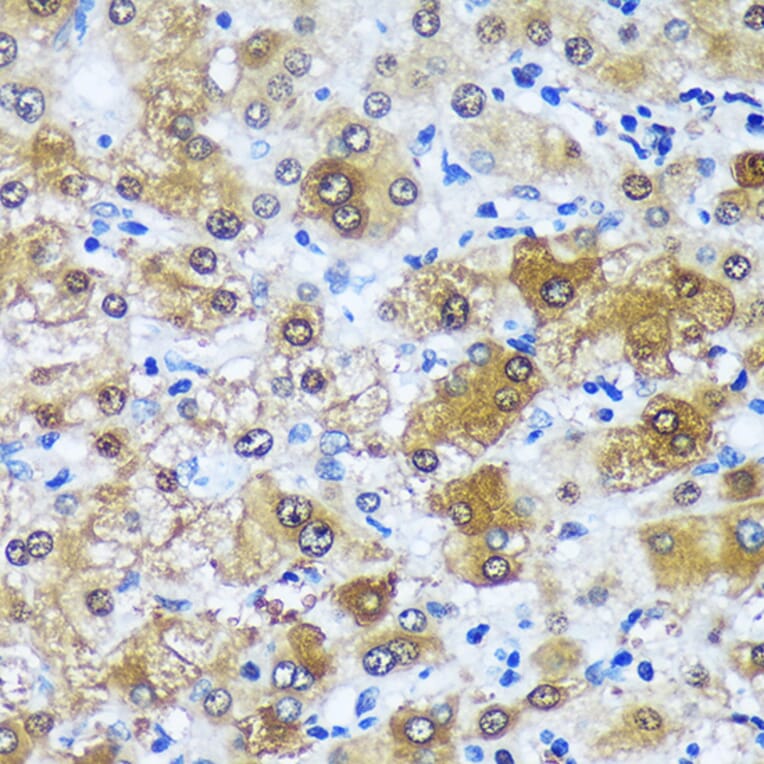 Immunohistochemistry - Anti-MBNL1 Antibody (A16054) - Antibodies.com