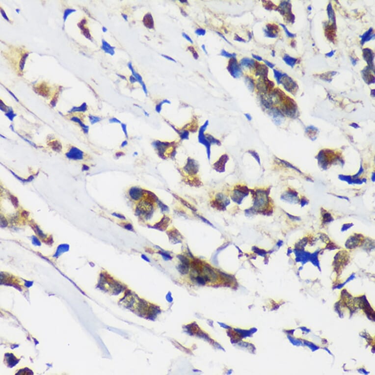 Immunohistochemistry - Anti-MBNL1 Antibody (A16054) - Antibodies.com