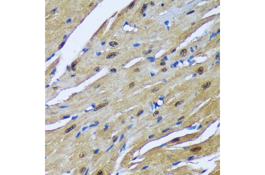 Immunohistochemistry - Anti-MBNL1 Antibody (A16054) - Antibodies.com
