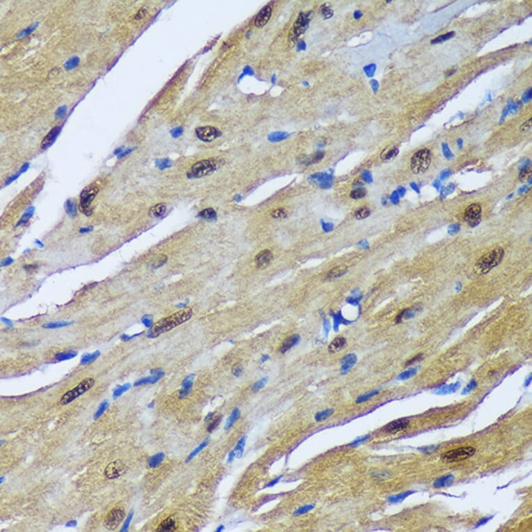 Immunohistochemistry - Anti-MBNL1 Antibody (A16054) - Antibodies.com