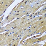 Immunohistochemistry - Anti-MBNL1 Antibody (A16054) - Antibodies.com