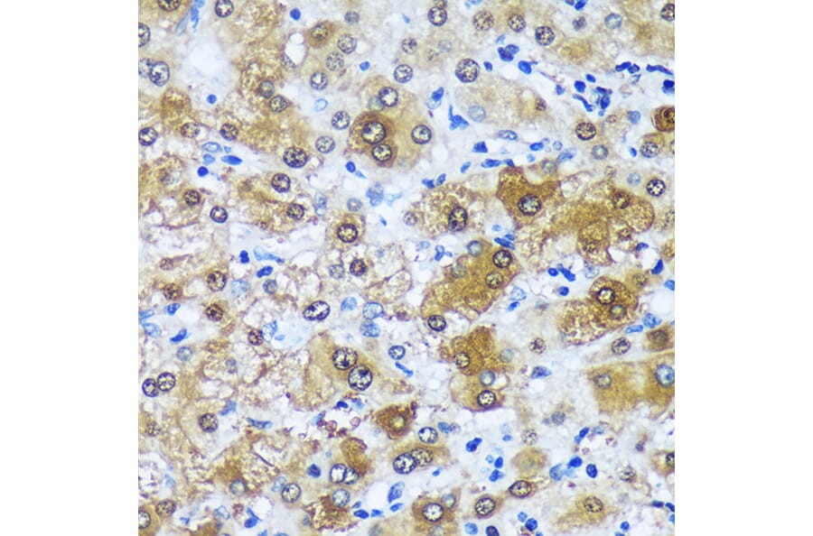 Immunohistochemistry - Anti-MBNL1 Antibody (A16054) - Antibodies.com