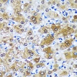 Immunohistochemistry - Anti-MBNL1 Antibody (A16054) - Antibodies.com