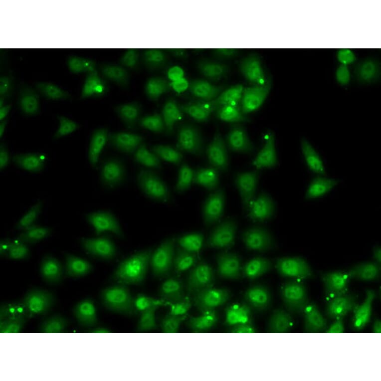 Immunofluorescence - Anti-MBNL1 Antibody (A16054) - Antibodies.com