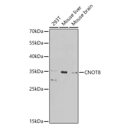 Western Blot - Anti-CNOT8 Antibody (A16055) - Antibodies.com
