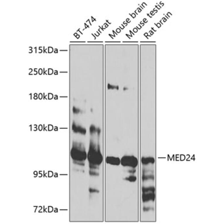 Western Blot - Anti-TRAP100/MED24 Antibody (A16056) - Antibodies.com
