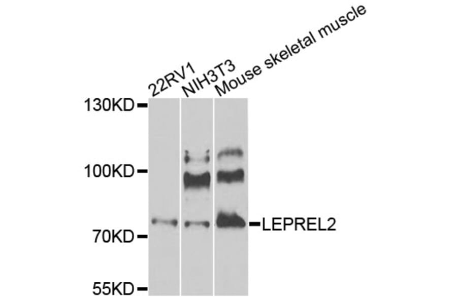 Western Blot - Anti-LEPREL2 Antibody (A8062) - Antibodies.com
