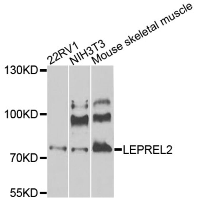 Western Blot - Anti-LEPREL2 Antibody (A8062) - Antibodies.com