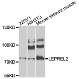 Western Blot - Anti-LEPREL2 Antibody (A8062) - Antibodies.com