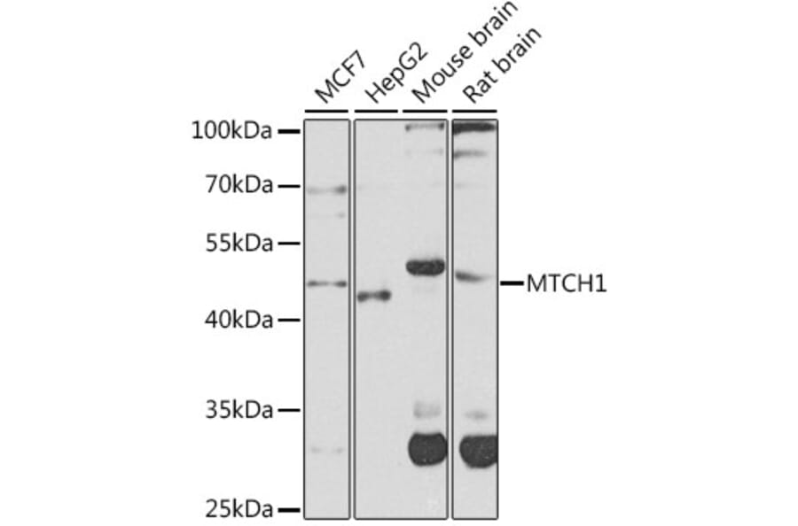 Western Blot - Anti-MTCH1/PSAP Antibody (A16058) - Antibodies.com