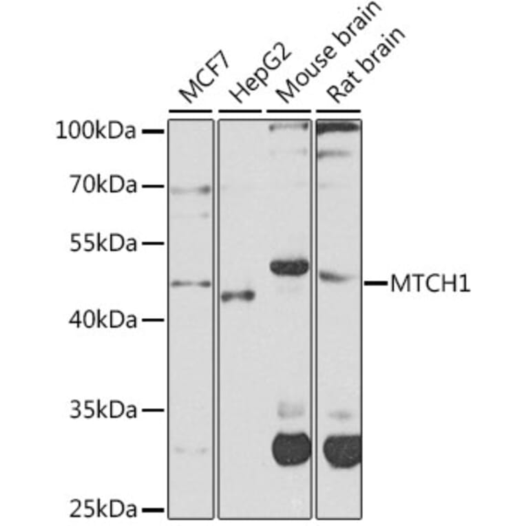 Western Blot - Anti-MTCH1/PSAP Antibody (A16058) - Antibodies.com