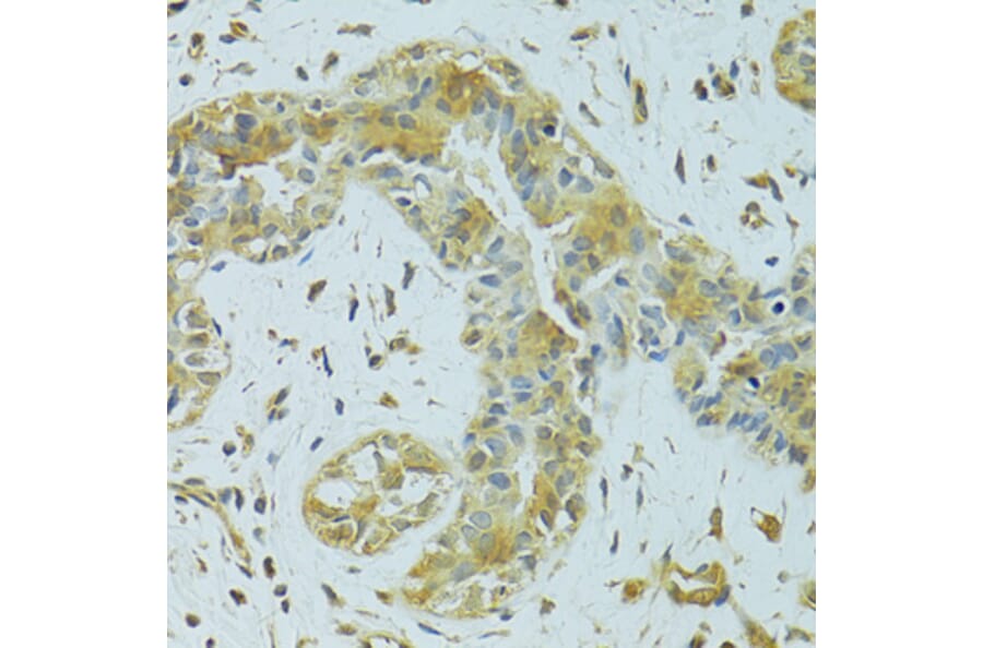 Immunohistochemistry - Anti-MTCH1/PSAP Antibody (A16058) - Antibodies.com