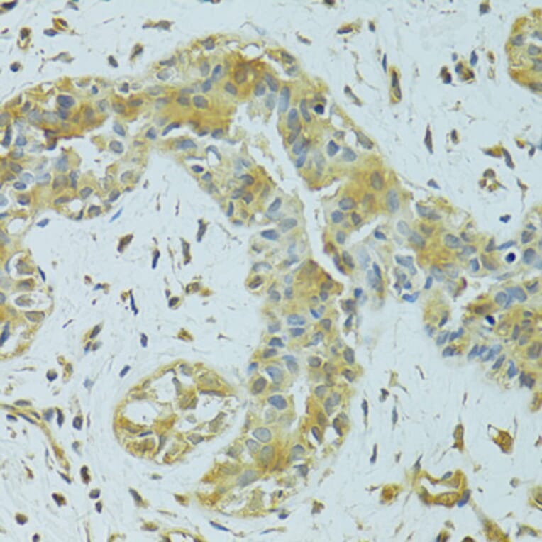 Immunohistochemistry - Anti-MTCH1/PSAP Antibody (A16058) - Antibodies.com