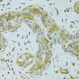 Immunohistochemistry - Anti-MTCH1/PSAP Antibody (A16058) - Antibodies.com