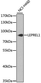Western blot analysis of extracts of NCI-H460 cells, using Anti-LEPREL1 Antibody (A8068) at 1:1,000 dilution.
Secondary antibody: Goat Anti-Rabbit IgG (H+L) (HRP) (AS014) at 1:10,000 dilution.
Lysates / proteins: 25µg per lane.
Blocking buffer: 3% non-fat dry milk in TBST.
Detection: ECL Basic Kit (RM00020).
Exposure time: 90s.