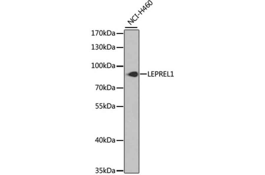 Western Blot - Anti-LEPREL1 Antibody (A16059) - Antibodies.com