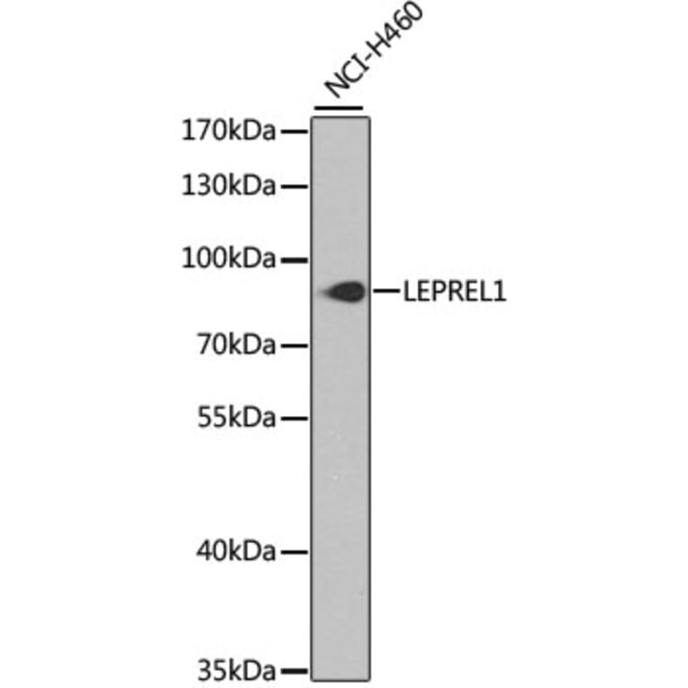 Western Blot - Anti-LEPREL1 Antibody (A16059) - Antibodies.com