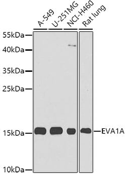 Western blot analysis of extracts of various cell lines, using Anti-EVA1A Antibody (A8070) at 1:1,000 dilution.
Secondary antibody: Goat Anti-Rabbit IgG (H+L) (HRP) (AS014) at 1:10,000 dilution.
Lysates / proteins: 25µg per lane.
Blocking buffer: 3% non-fat dry milk in TBST.
Detection: ECL Basic Kit (RM00020).
Exposure time: 90s.
