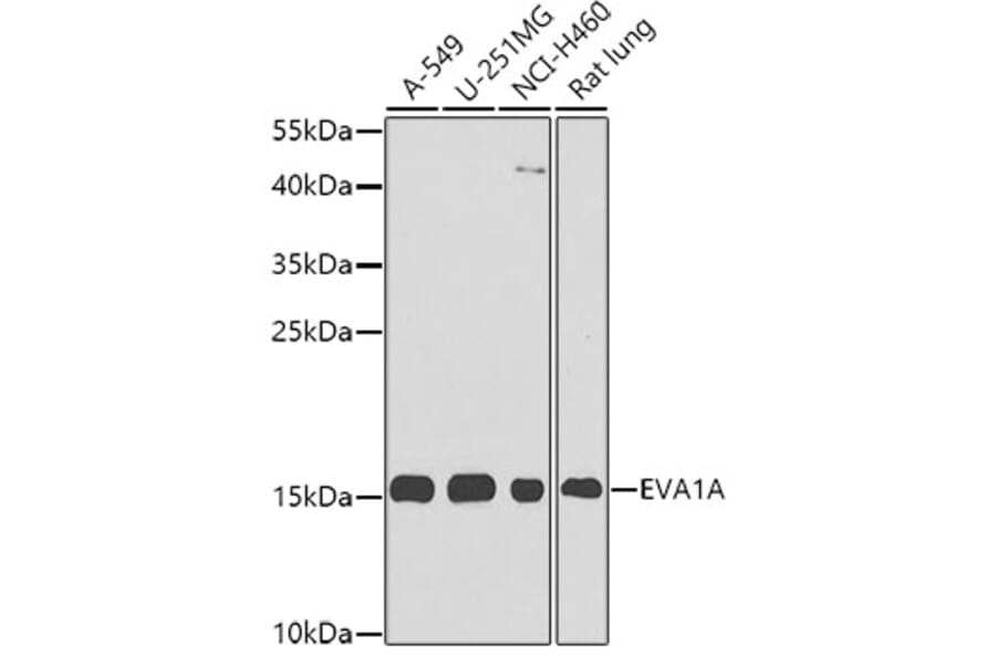 Western Blot - Anti-EVA1A Antibody (A8070) - Antibodies.com