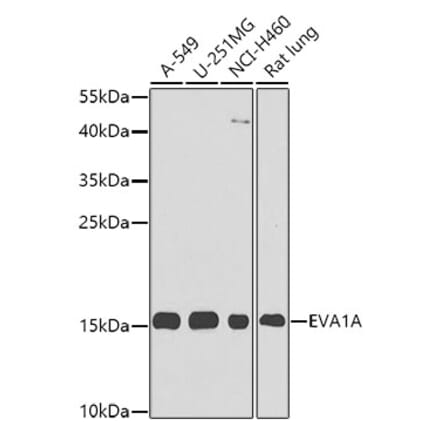 Western Blot - Anti-EVA1A Antibody (A8070) - Antibodies.com