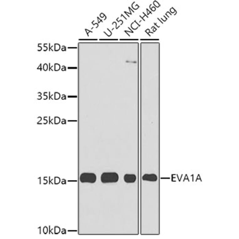 Western Blot - Anti-EVA1A Antibody (A8070) - Antibodies.com