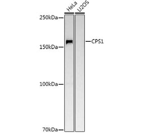 Western Blot - Anti-CPS1 Antibody (A16062) - Antibodies.com