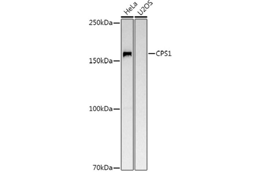 Western Blot - Anti-CPS1 Antibody (A16062) - Antibodies.com