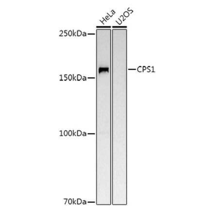 Western Blot - Anti-CPS1 Antibody (A16062) - Antibodies.com