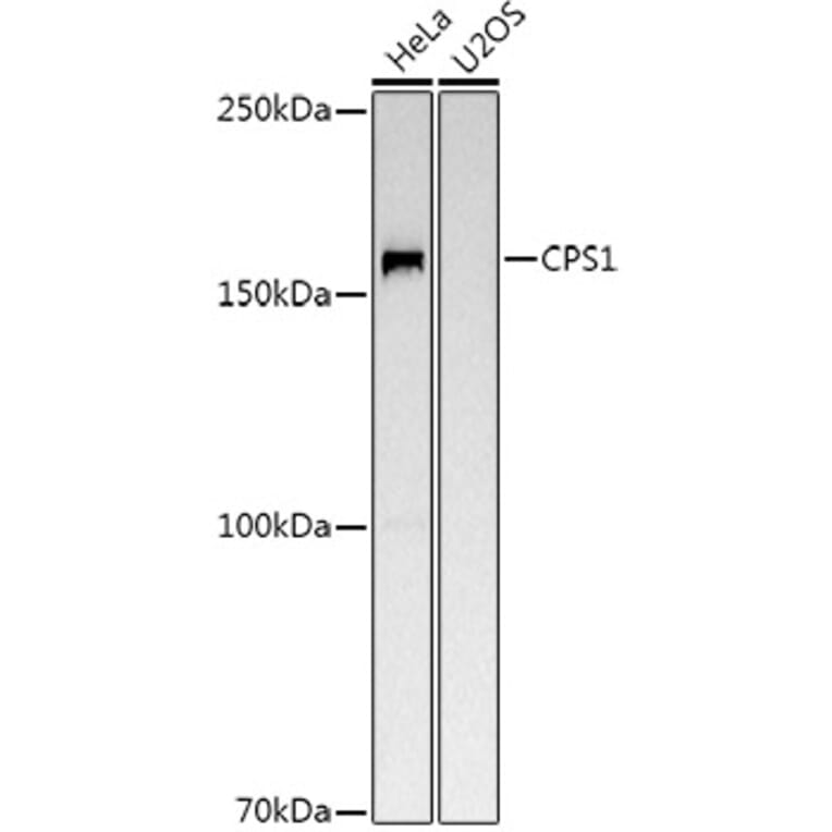 Western Blot - Anti-CPS1 Antibody (A16062) - Antibodies.com
