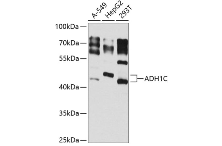 Western Blot - Anti-ADH1C Antibody (A16063) - Antibodies.com