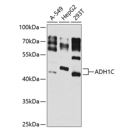 Western Blot - Anti-ADH1C Antibody (A16063) - Antibodies.com