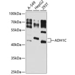 Western Blot - Anti-ADH1C Antibody (A16063) - Antibodies.com