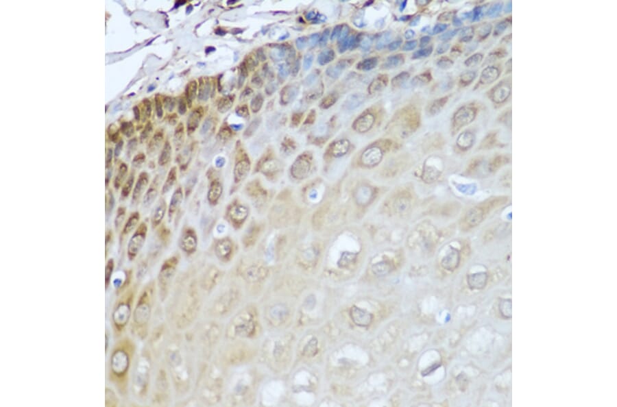 Immunohistochemistry - Anti-ADH1C Antibody (A16063) - Antibodies.com