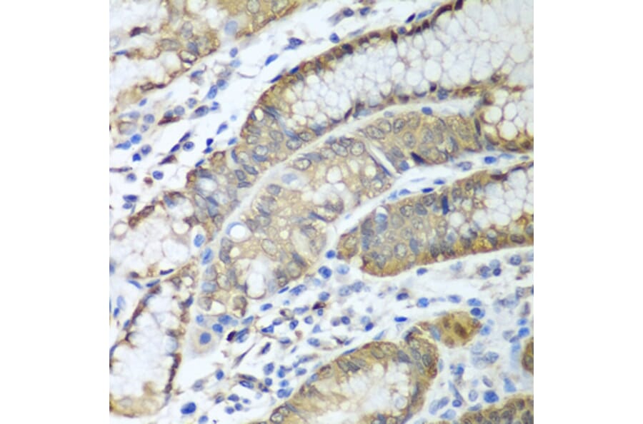Immunohistochemistry - Anti-ADH1C Antibody (A16063) - Antibodies.com