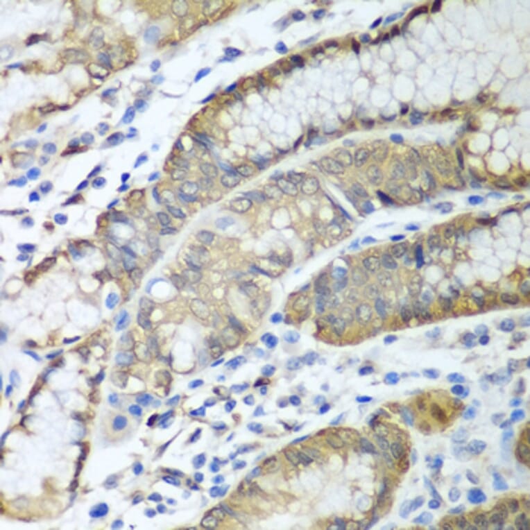 Immunohistochemistry - Anti-ADH1C Antibody (A16063) - Antibodies.com