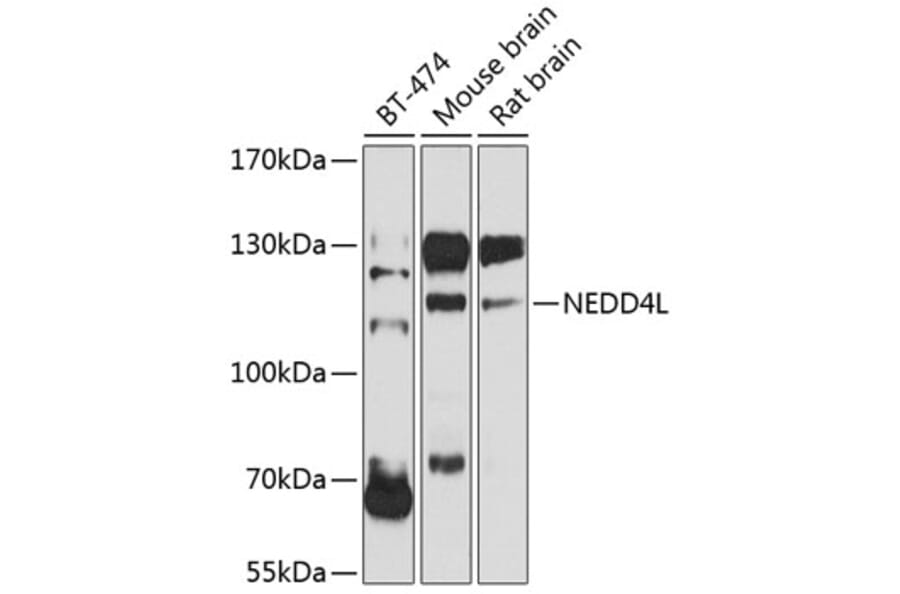 Western Blot - Anti-NEDD4-2 Antibody (A16064) - Antibodies.com