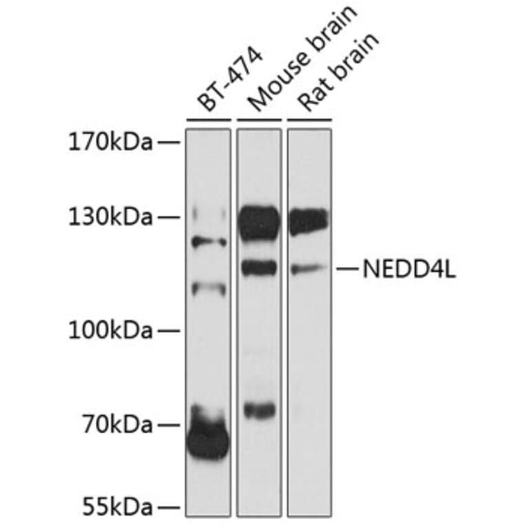 Western Blot - Anti-NEDD4-2 Antibody (A16064) - Antibodies.com