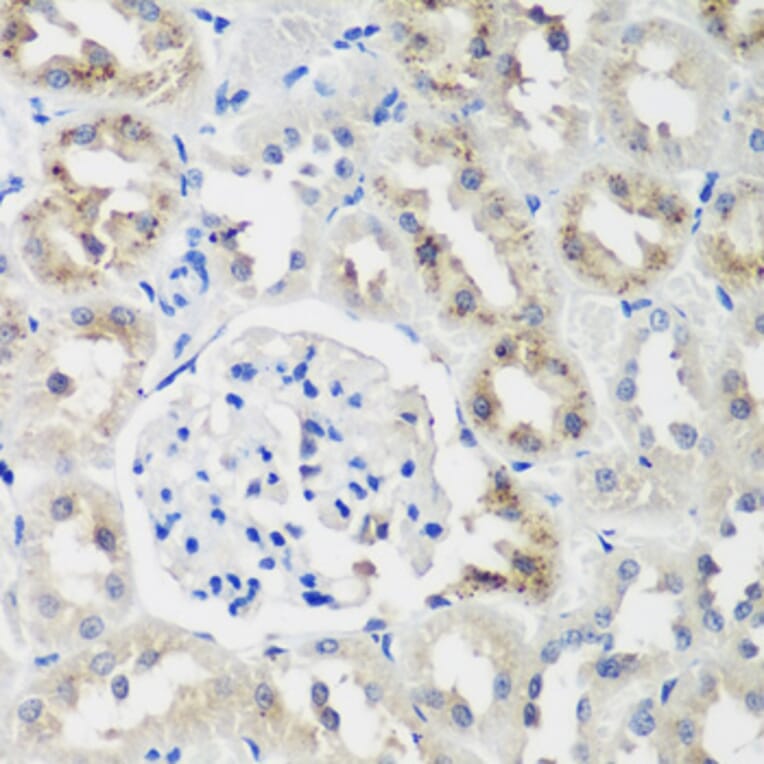Immunohistochemistry - Anti-NEDD4-2 Antibody (A16064) - Antibodies.com