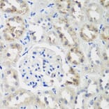 Immunohistochemistry - Anti-NEDD4-2 Antibody (A16064) - Antibodies.com
