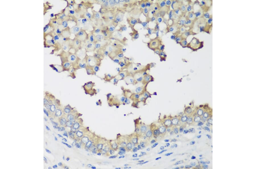Immunohistochemistry - Anti-NEDD4-2 Antibody (A16064) - Antibodies.com