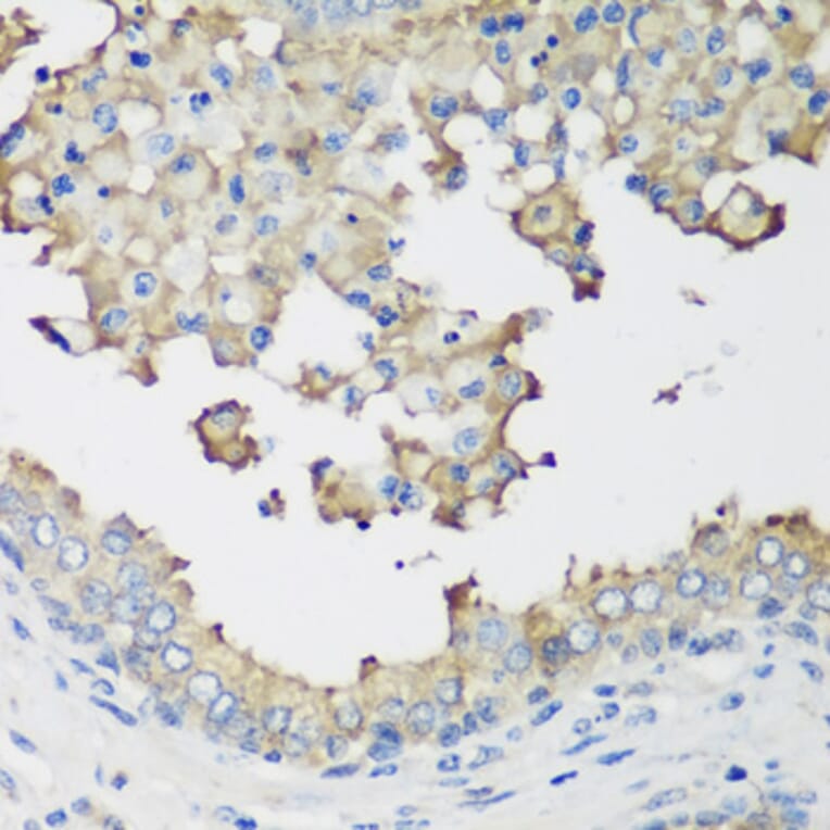 Immunohistochemistry - Anti-NEDD4-2 Antibody (A16064) - Antibodies.com