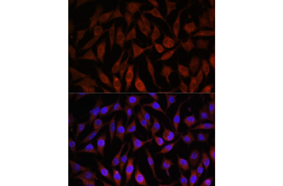 Immunofluorescence - Anti-NEDD4-2 Antibody (A16064) - Antibodies.com